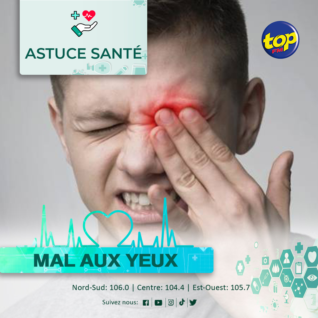 Astuce Sant Que Faire Lorsqu on A Mal Aux Yeux TOP FM Mauritius
