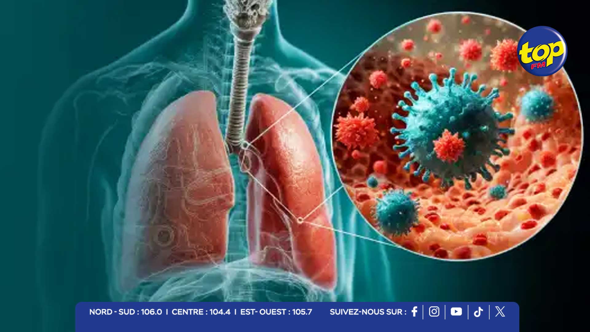 Infections-respiratoires