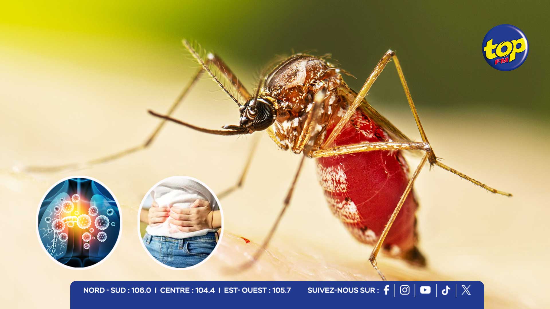 chikungunya