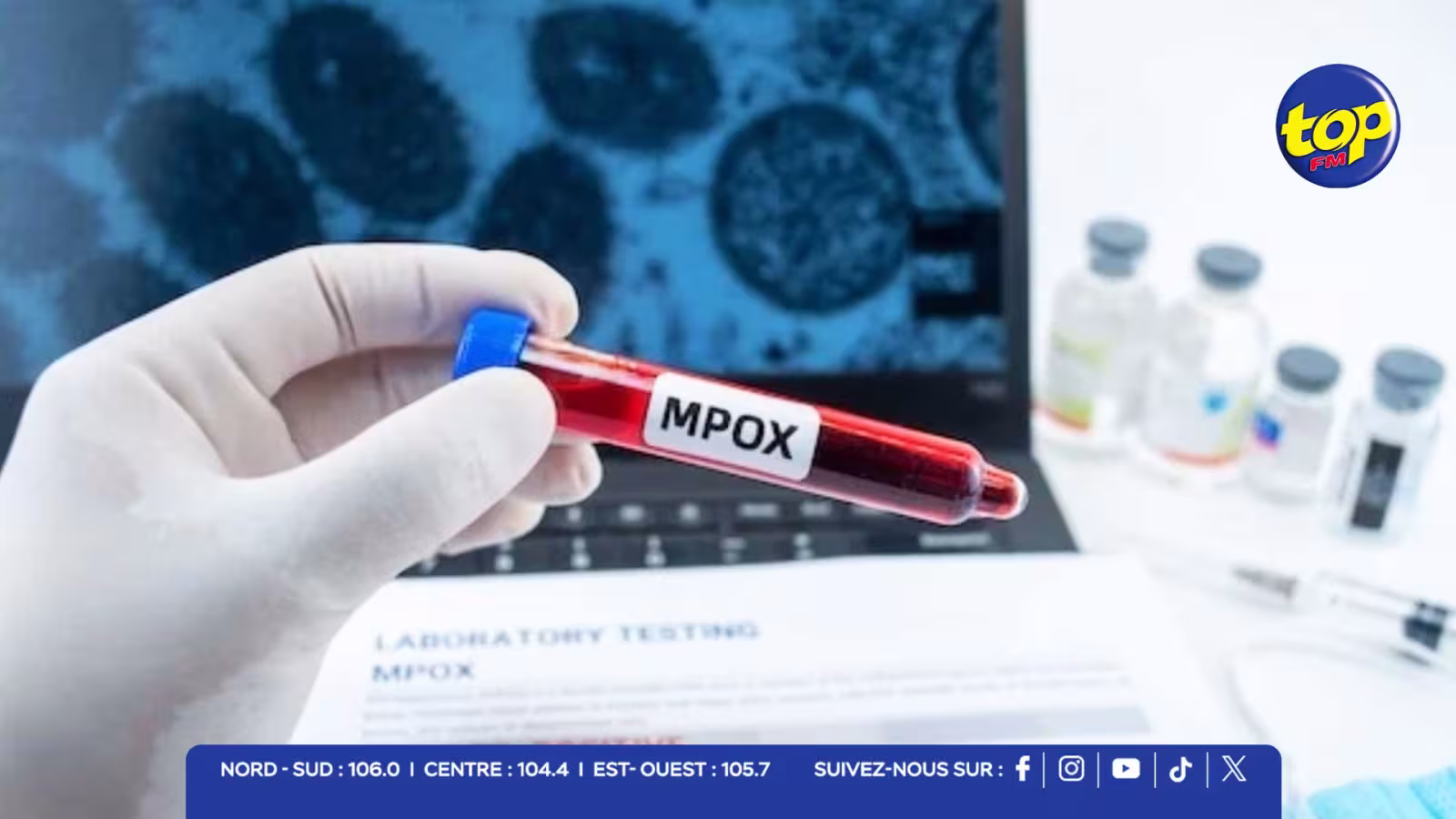 Mpox : 2 cas confirmés