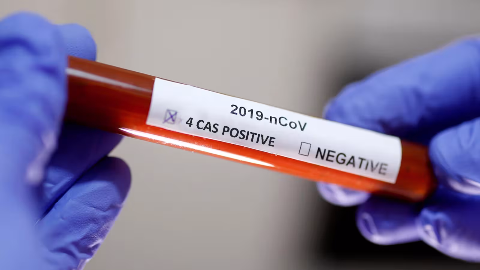 Covid-19 : Quatre nouveaux cas enregistrés cet après-midi