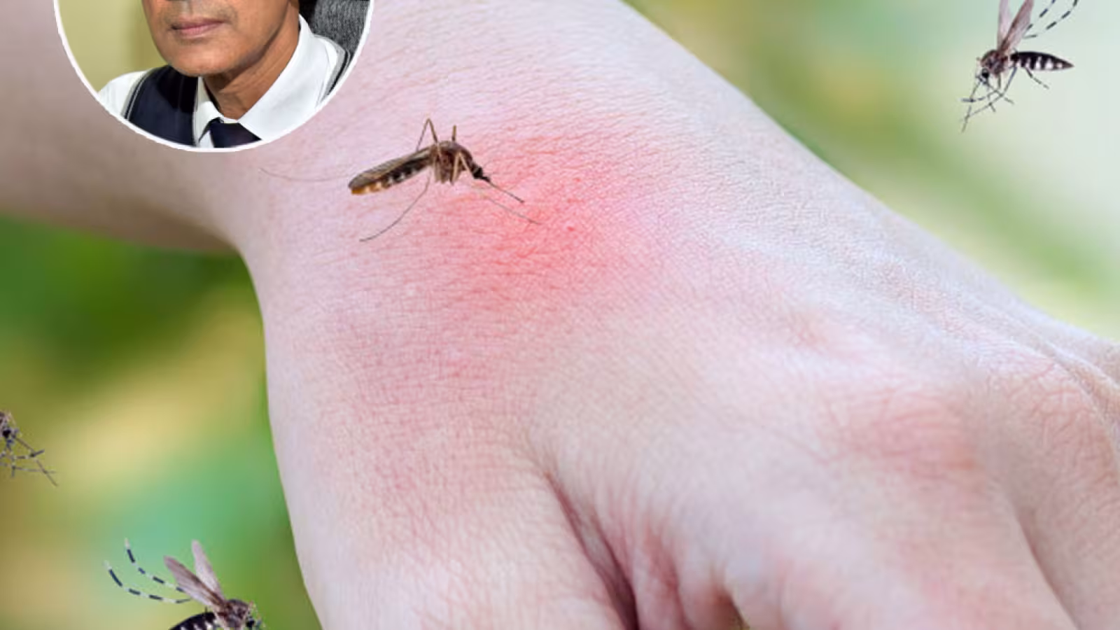 DENGUE CHIKUNGUNYA