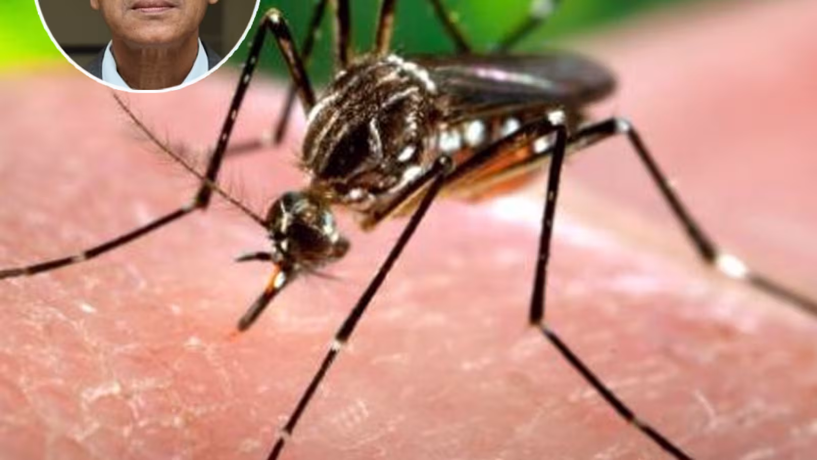 Chikungunya : Cinq cas enregistrés en une semaine