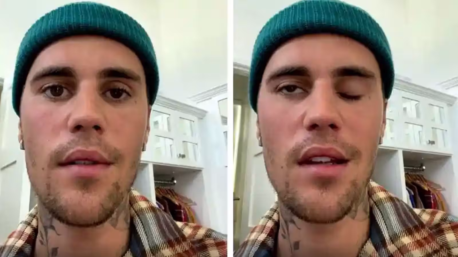 Justin Bieber souffre d’une paralysie au visage et annule plusieurs dates de tournée
