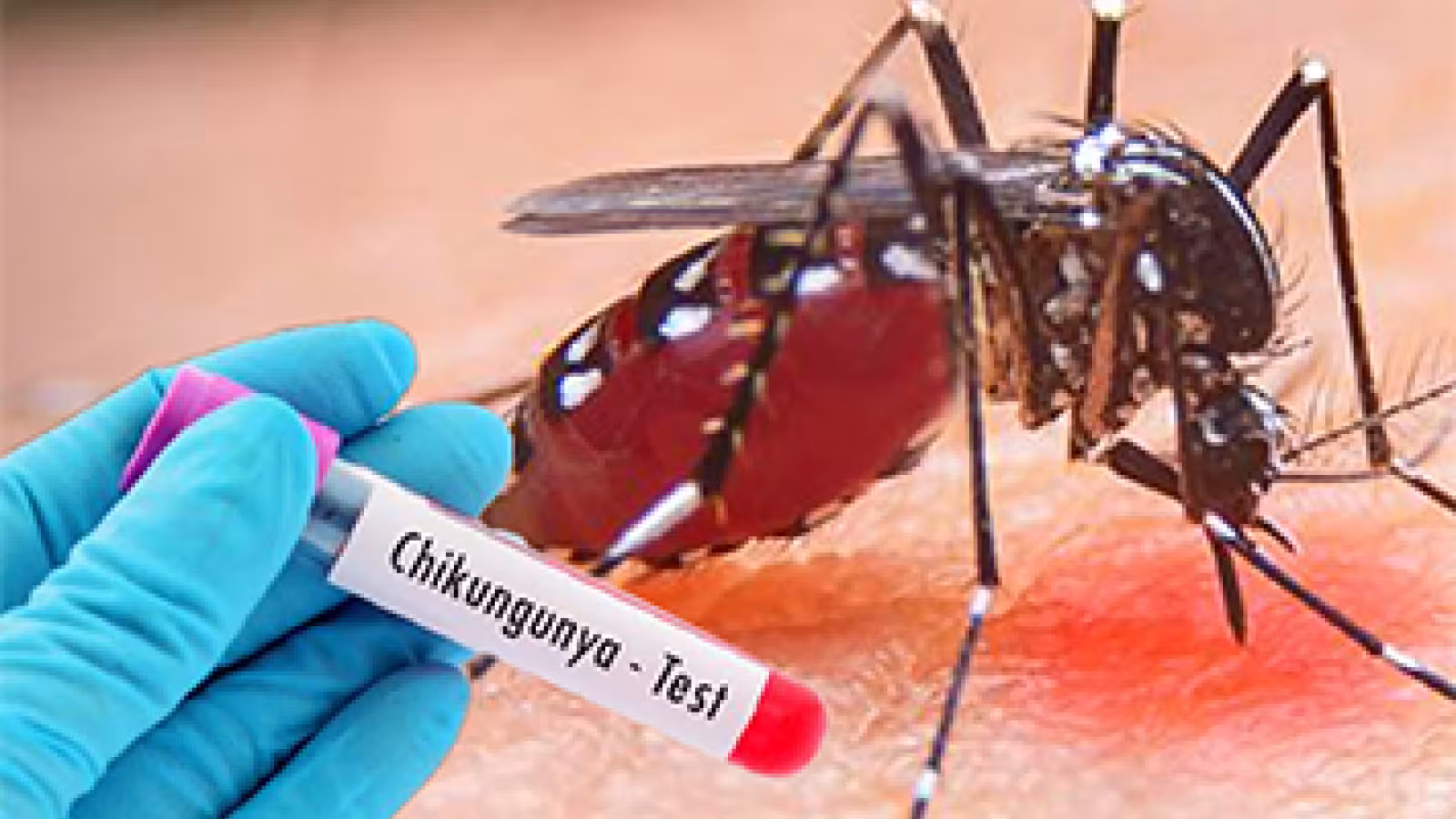 Chikungunya à la Réunion : lancement d’une campagne de vaccination pour les plus de 65 ans