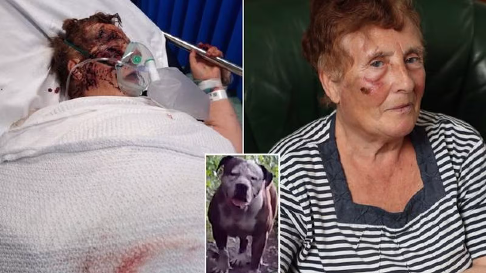 Un pitbull attaque une fillette et tente de la tuer