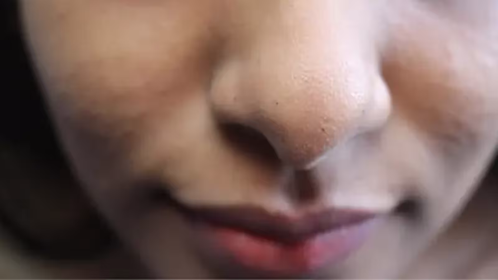 Comment se débarasser des points noirs naturellement