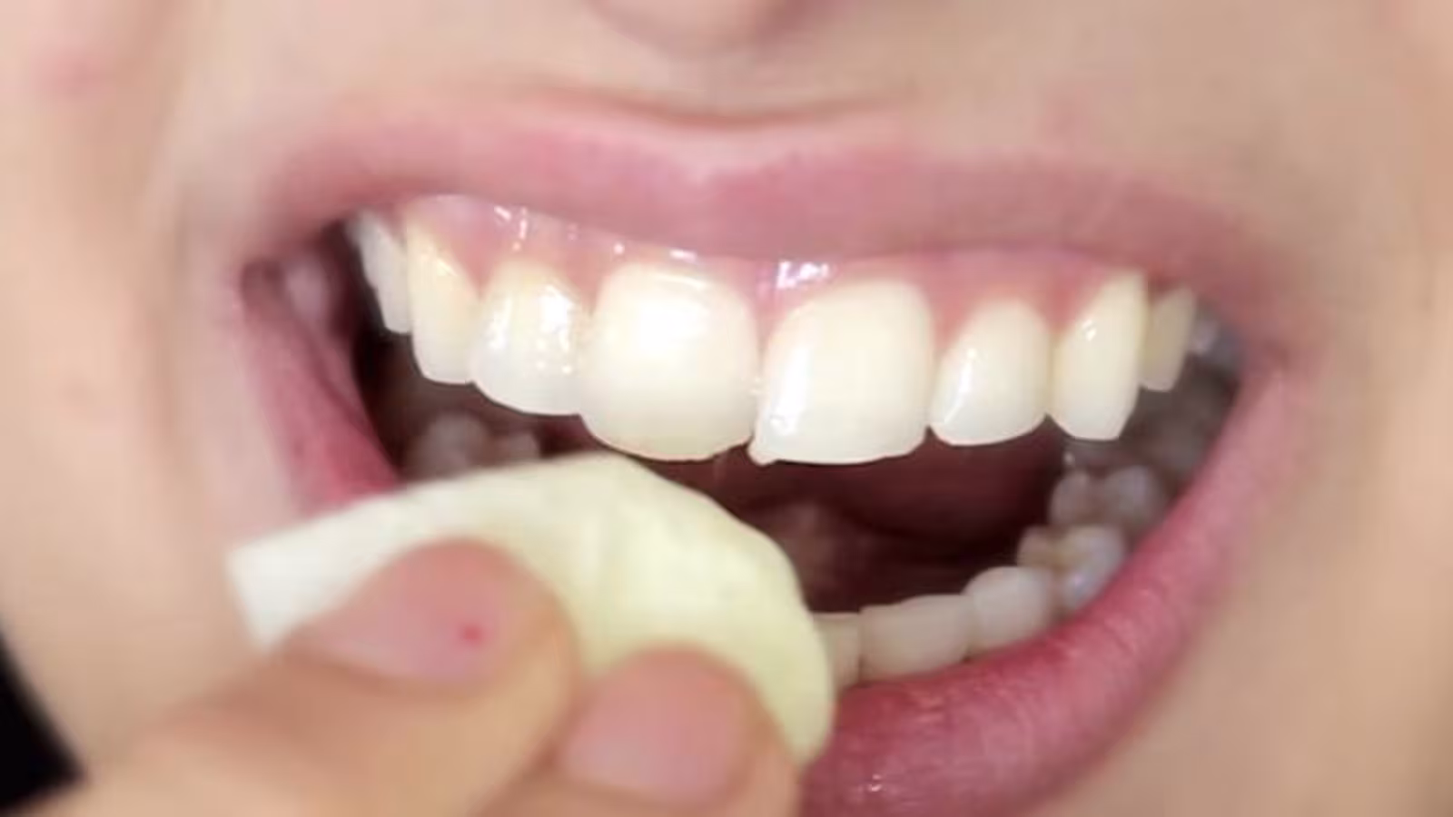 Astuce pour lutter contre les dents jaunes