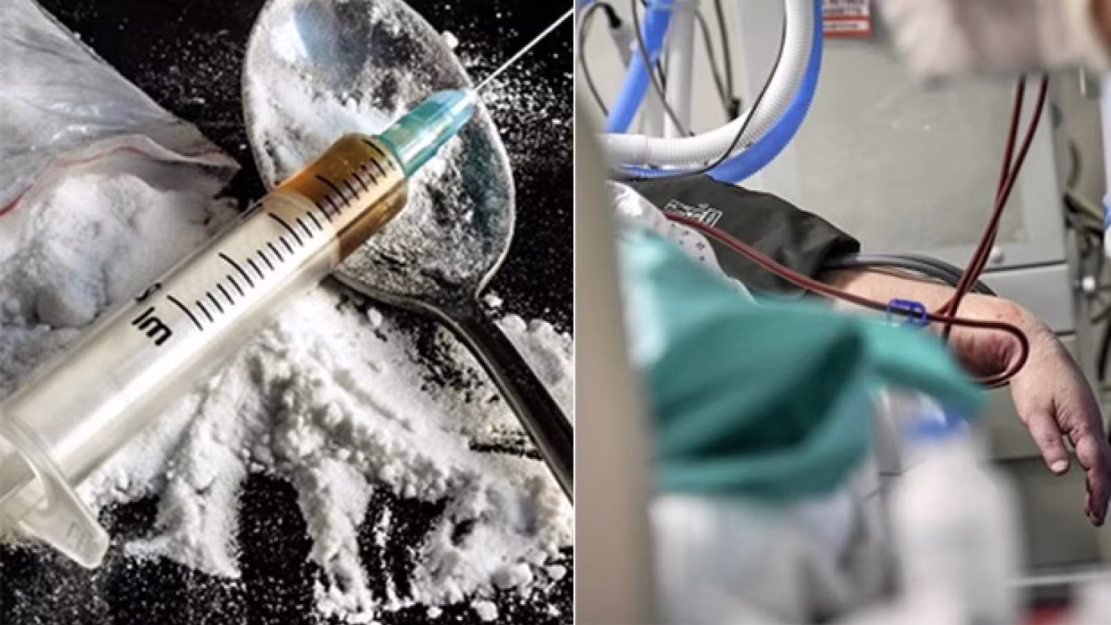 Nouvelle drogue à La Réunion : deux nouvelles victimes hospitalisées, l’un est en réanimation