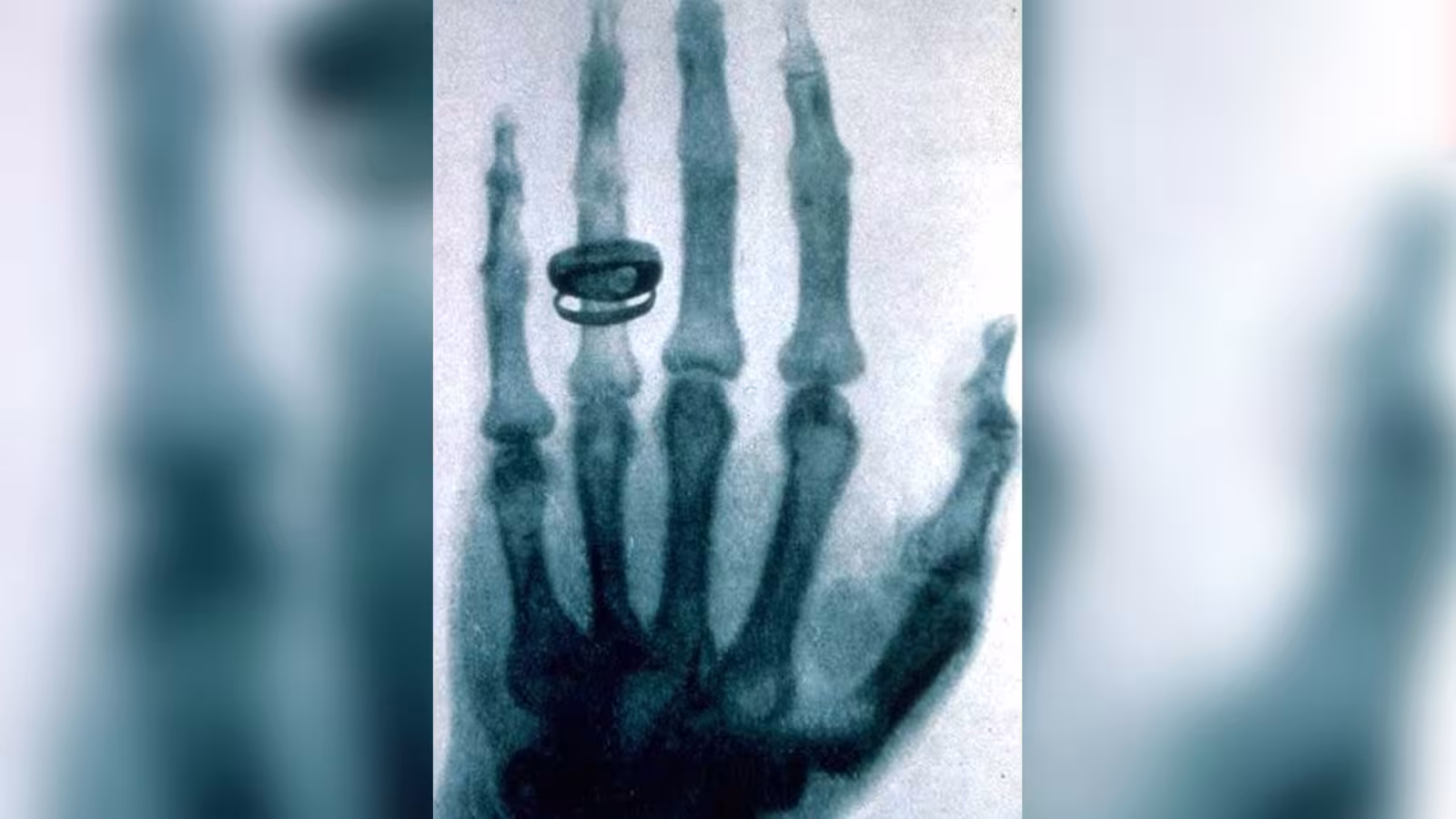 Journée internationale de la radiologie