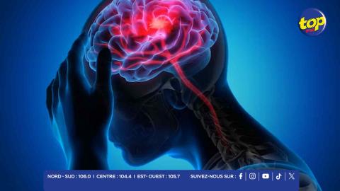 Accidents vasculaires cérébraux