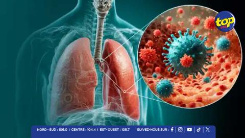 Infections-respiratoires