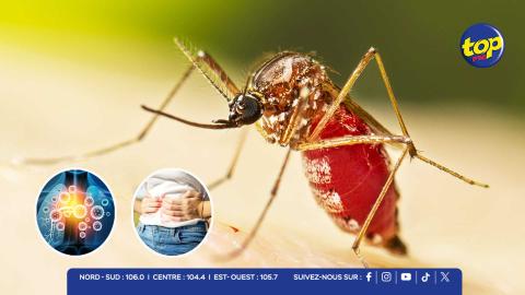 chikungunya
