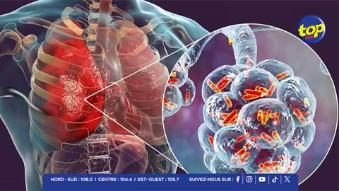 Les cas de grippe et d’infections respiratoires en hausse