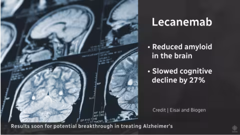 Un traitement enfin trouvé contre la maladie d’Alzheimer
