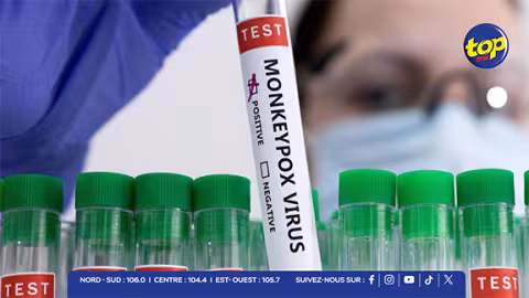 La Réunion : deux nouveaux cas de Mpox détectés, portant le total à 6 depuis le début de l’année