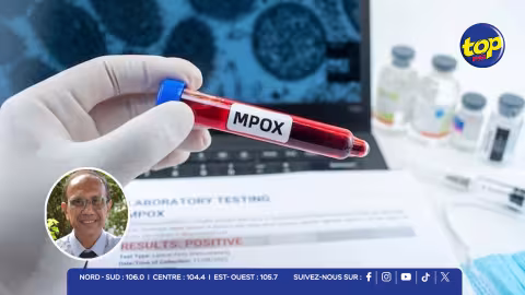 MPOX