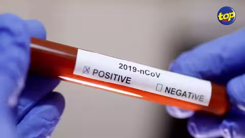En cas de contact avec un patient positif : Un protocole spécial pour les membres du personnel soignant qui ont déjà reçu la première dose du vaccin
