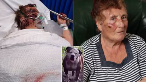 Un pitbull attaque une fillette et tente de la tuer