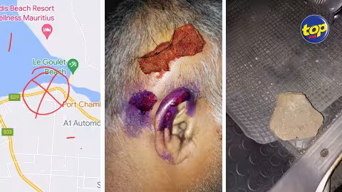 À Baie du Tombeau : Victime de jets de pierres, un conducteur blessé à la tête