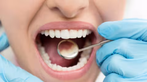 Prévenir les caries : l’alimentation et les gestes au quotidien