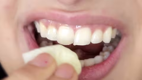 Astuce pour lutter contre les dents jaunes
