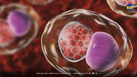 Maladies sexuellement transmissibles
