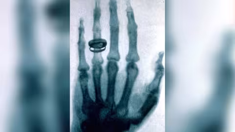 Journée internationale de la radiologie